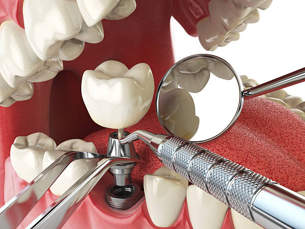 Best Cracked Tooth Emergency Dentist  in East Aurora, NY